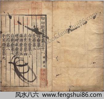 幼幼新书.残一卷.卷三十八.卷南宋刘昉等辑撰.宋刻本