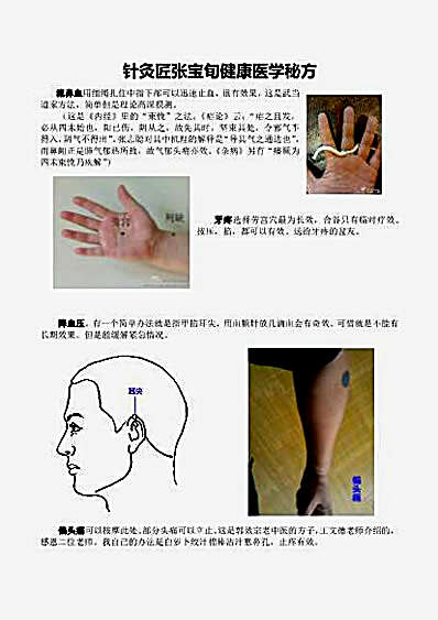 针灸匠张宝旬健康医学秘方.完整版.pdf 针灸匠张宝旬健康医学秘方.完整版.pdf