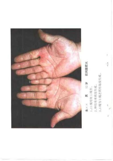 现代掌纹诊病_王晨霞.电子版.pdf