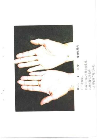 现代掌纹诊病_王晨霞.电子版.pdf